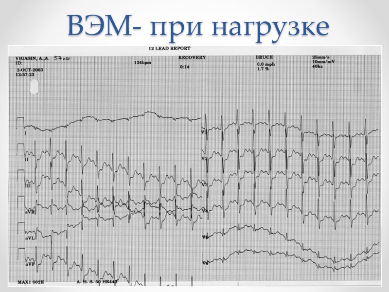 ВЭМ- при нагрузке ВЭМ- при нагрузке